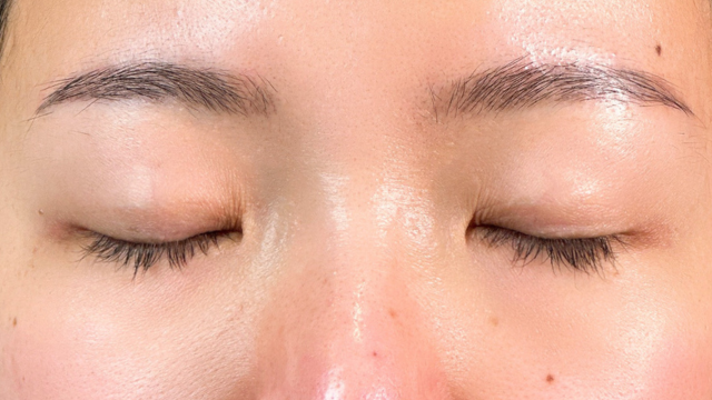 Preoperative Condition Part 1