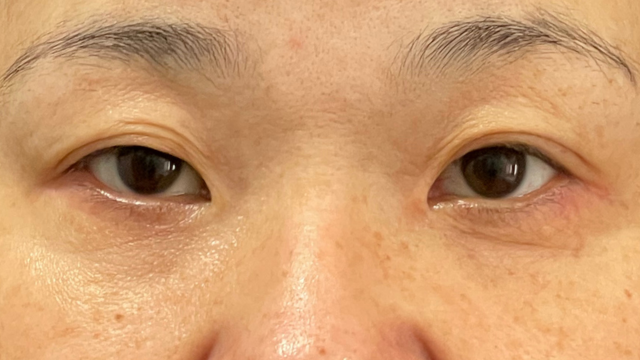 Preoperative Condition Part 1