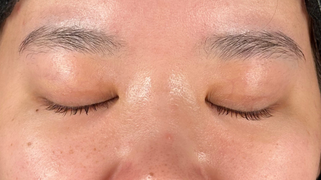 Preoperative Condition Part 1