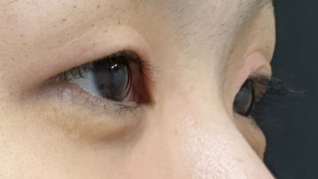 Preoperative Condition Part 1