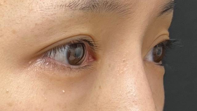 Preoperative Condition Part 1