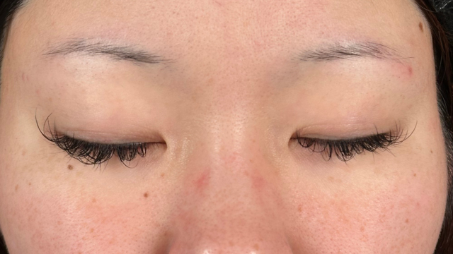 Preoperative Condition Part 1