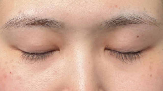 Preoperative Condition Part 1