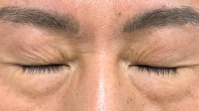 Preoperative Condition Part 1