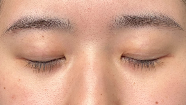 Preoperative Condition Part 1