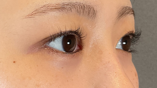 Preoperative Condition Part 1