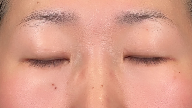 Preoperative Condition Part 1