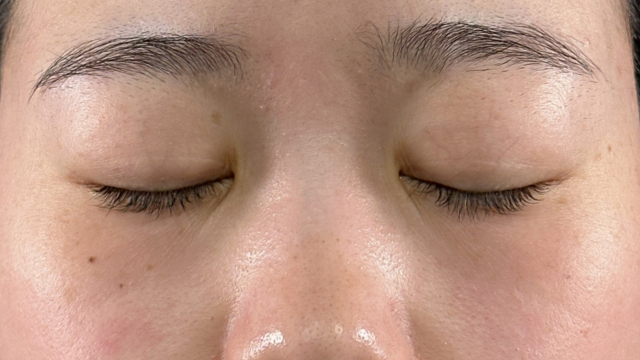 Preoperative Condition Part 1