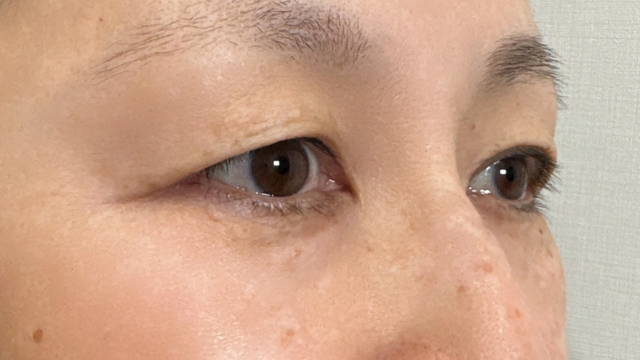 Preoperative Condition Part 1