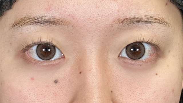 Preoperative Condition Part 1