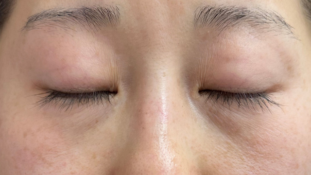 Preoperative Condition Part 1