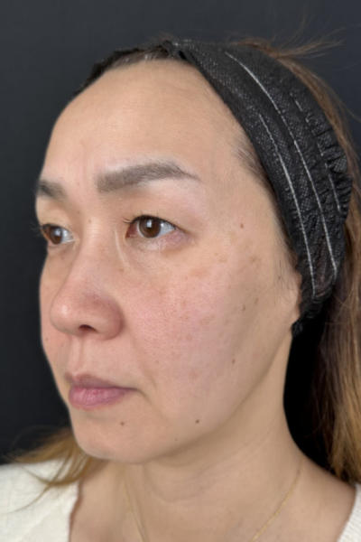 Preoperative Condition Part 1