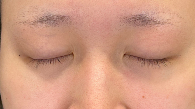 Preoperative Condition Part 1