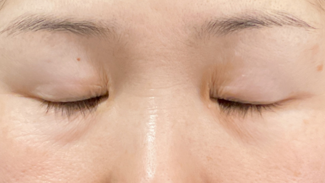 Preoperative Condition Part 1