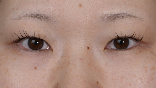 Preoperative Condition Part 1