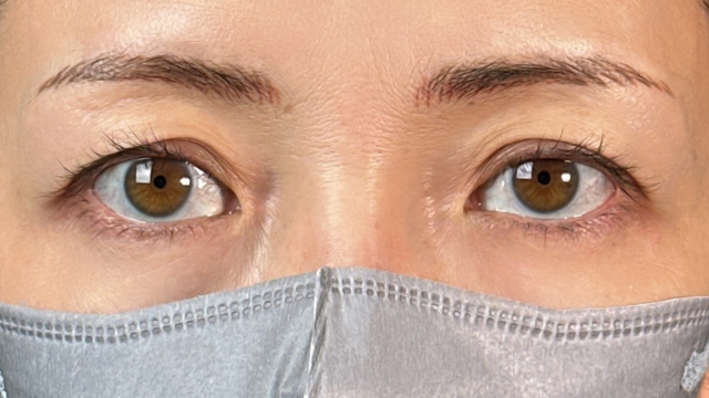 Preoperative Condition Part 1