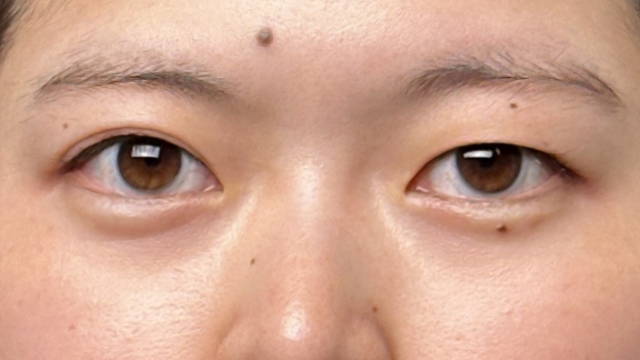 Preoperative Condition Part 1