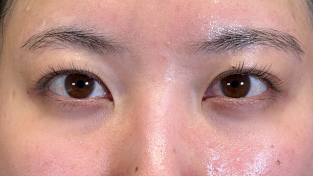 Preoperative Condition Part 1