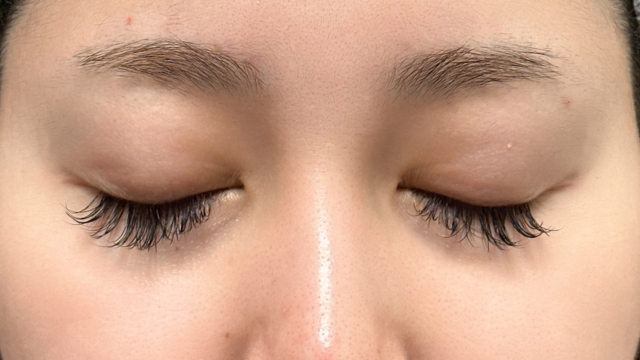 Preoperative Condition Part 1