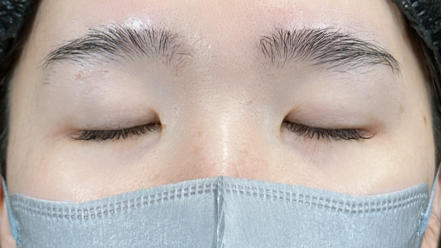 Preoperative Condition Part 1