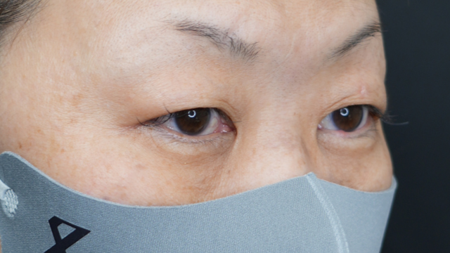 Preoperative Condition Part 1