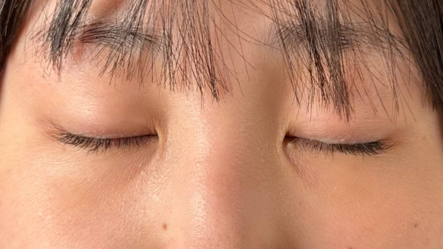 Preoperative Condition Part 1