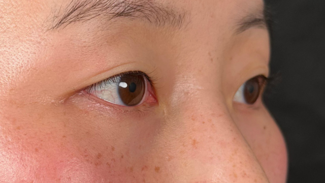 Preoperative Condition Part 1