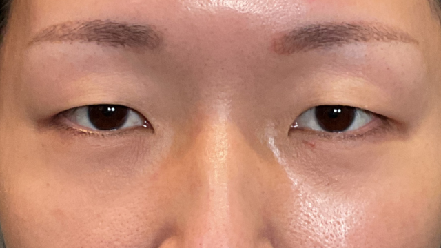 Preoperative Condition Part 1