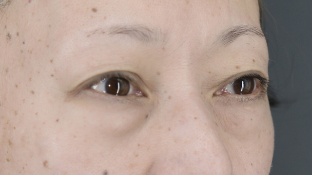 Preoperative Condition Part 1