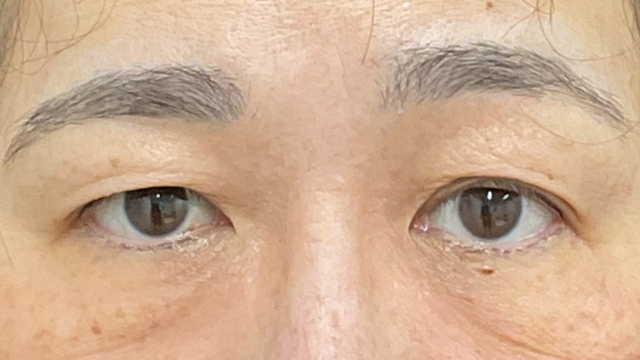 Preoperative Condition Part 1