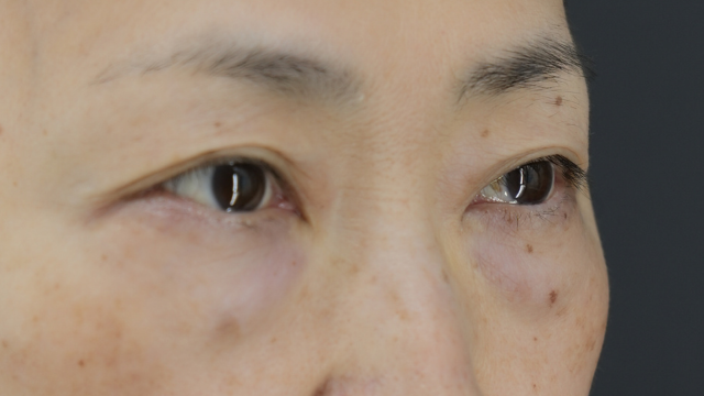 Preoperative Condition Part 1