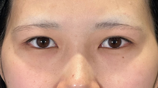 Preoperative Condition Part 1