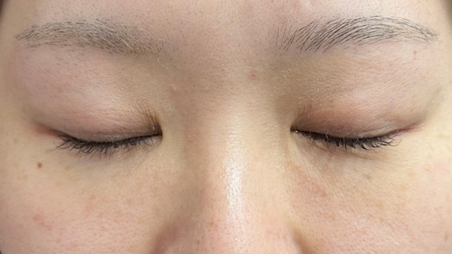 Preoperative Condition Part 1