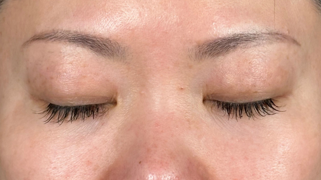 Preoperative Condition Part 1