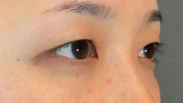 Preoperative Condition Part 1