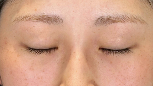 Preoperative Condition Part 1