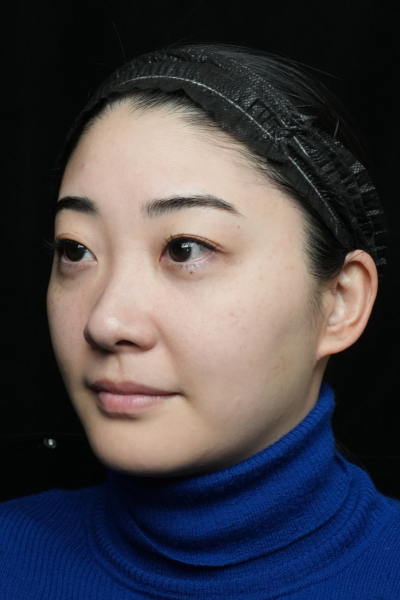 Preoperative Condition Part 1