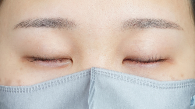 Preoperative Condition Part 1