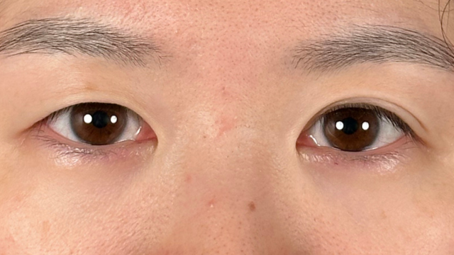 Preoperative Condition Part 1