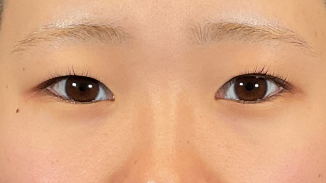 Preoperative Condition Part 1