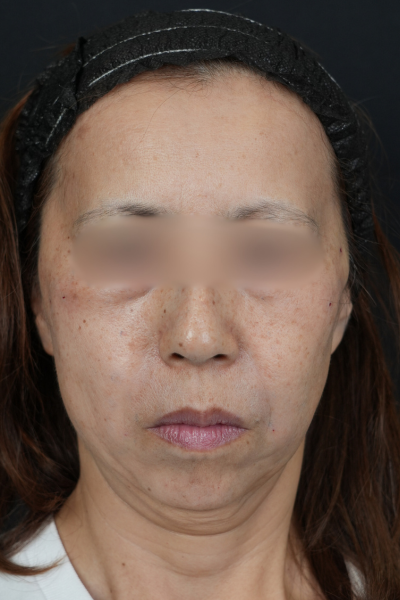 Preoperative Condition Part 1