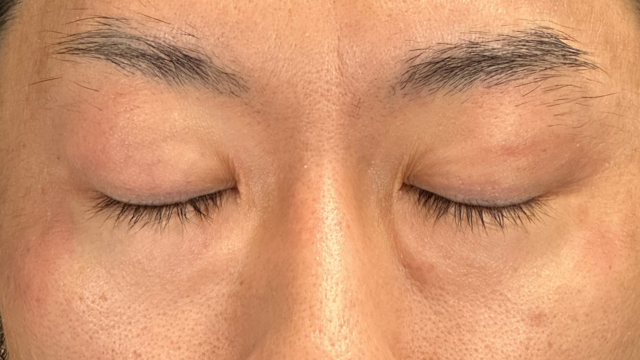 Preoperative Condition Part 1