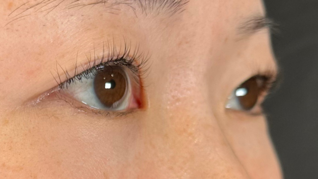 Preoperative Condition Part 1