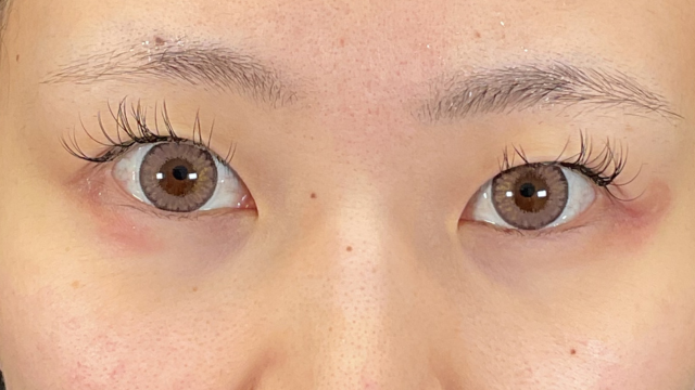 Preoperative Condition Part 1