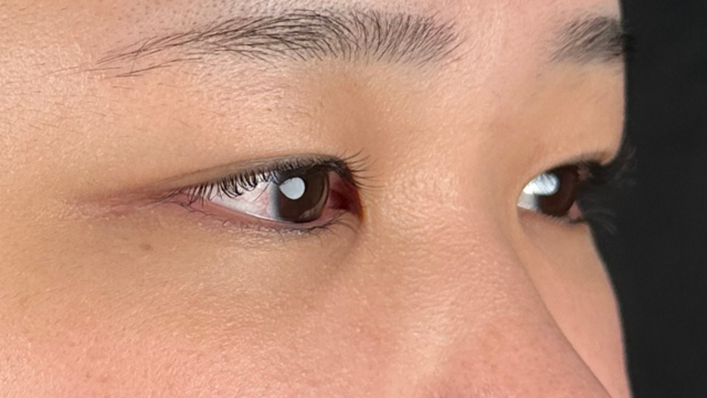 Preoperative Condition Part 1