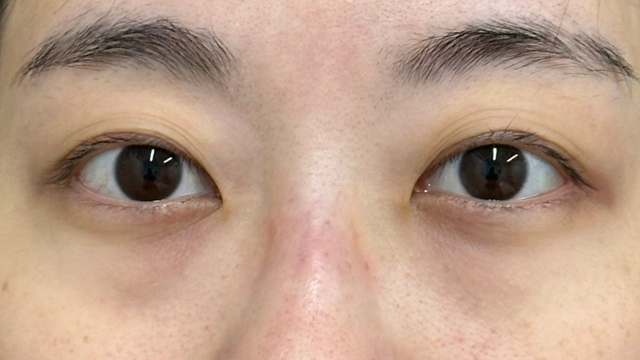 Preoperative Condition Part 1