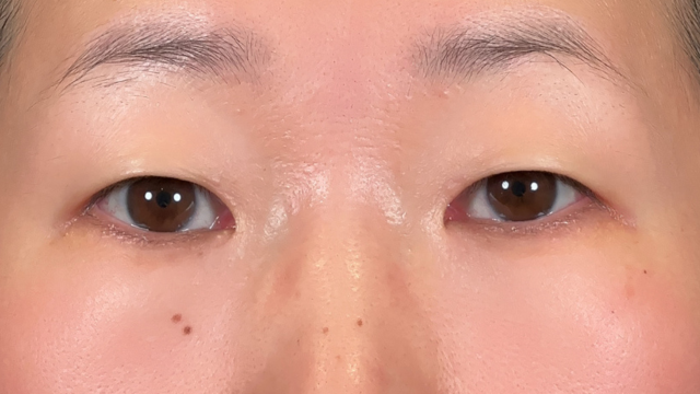 Preoperative Condition Part 1