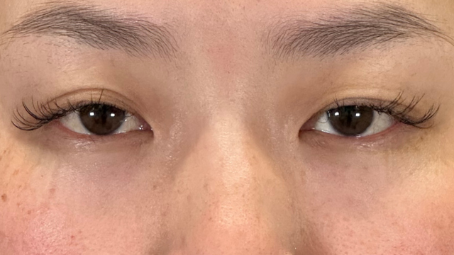 Preoperative Condition Part 1