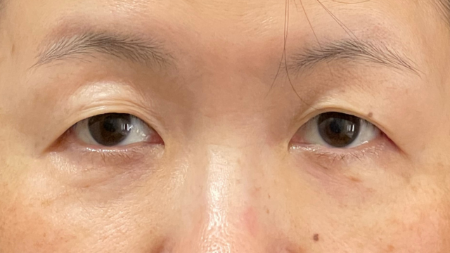 Preoperative Condition Part 1