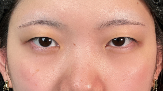 Preoperative Condition Part 1